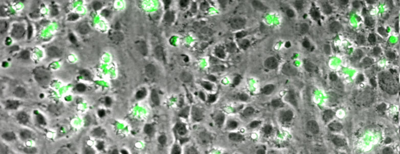 Enlarged view: Leukocyte migration
